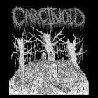 Carcinoid - Carcinoid