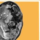 Crawl Space - Crawl Space