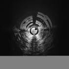 Conman, Evasion - Phase 1 EP