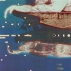 Hercules & Love Affair & Hips & Lips - Someone Else Is Calling