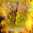 Apoplexy - Malignant Lobotomy