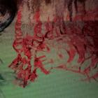 Remote Viewing - Blood Loss