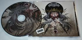 Onchocerciasis Esophagogastroduodenoscopy-Fugue Gnawed from the Scabbed God Cerebrum- SBR14 -CD-FLAC-2026-86D