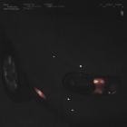 Skrillex - Hit Me Where It Hurts X