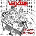 Vaxine - Frontal Lobotomy