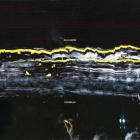 Gilla Band - Pugnello