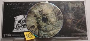 Fossilization-Advent of Wounds- SPIT108CD -CD-FLAC-2026-86D