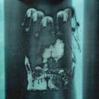 Edict - Redux