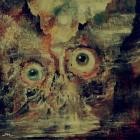 Teratoma - Purulent Manifestations