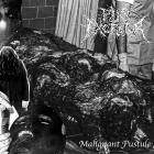 Pus Excretor - Malignant Pustule